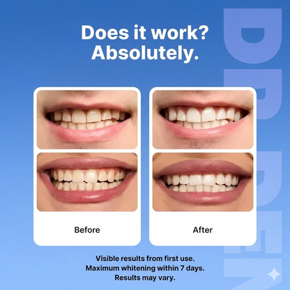 Dr Dent Whitening Strips